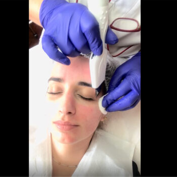 Ultra sonic Skin scrubber spatula